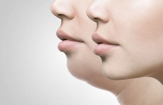 Η ιδανική συνταγή για να εξαφανίσεις το διπλοσάγονο. Σύσφιξη και τόνωση της περιοχής. Ανόρθωση.