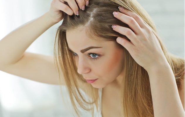 Τριχόπτωση: Τι πρέπει να προσέξετε στη διατροφή σας