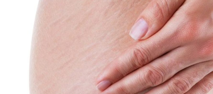 Τα γιατροσόφια της γιαγιάς για να νικήσετε τις ραγάδες