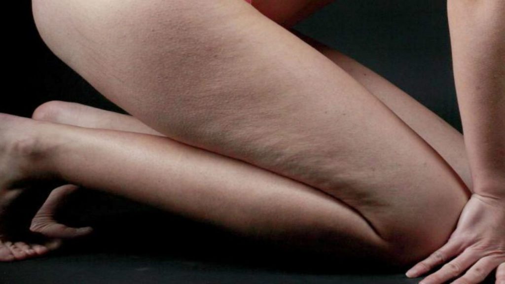 Τα πέντε καλύτερα σπιτικά scrub κατά της κυτταρίτιδας και της ξηρής επιδερμίδας